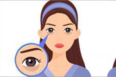 眼底脂肪再配置是什么意思，能祛除黑眼圈和眼袋吗？