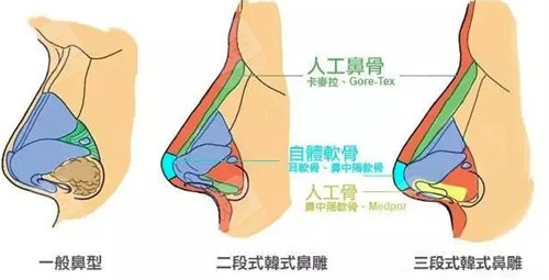 鼻型图 鼻型图