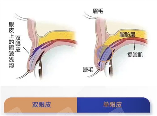 双眼皮跟单眼皮的结构展示 双眼皮跟单眼皮的结构展示