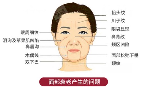 面部衰老产生的问题