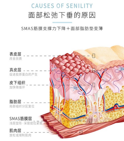 面部松弛下垂的原因