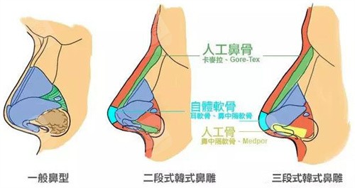 鼻型图 鼻型图