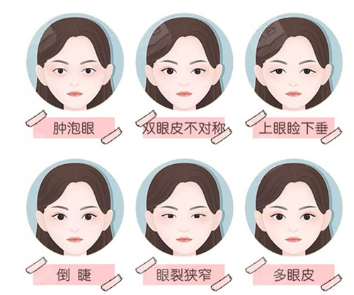 眼部整形适应症 眼部整形适应症