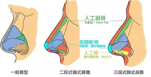 鼻型图 鼻型图