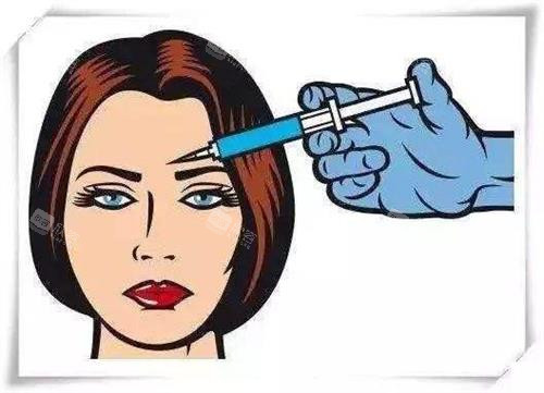 注射玻尿酸示意图
