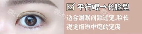 平行双眼皮照片 平行双眼皮照片