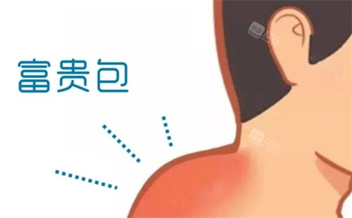 富贵包动画图 富贵包动画图