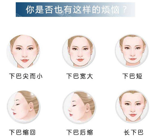 上饶荣美医疗美容怎么样?荣美整形医院好吗?