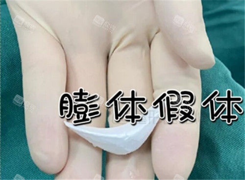 上海下巴整形的费用是多少硅胶假体下巴5000元的样子！