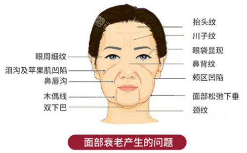 面部衰老带来的问题