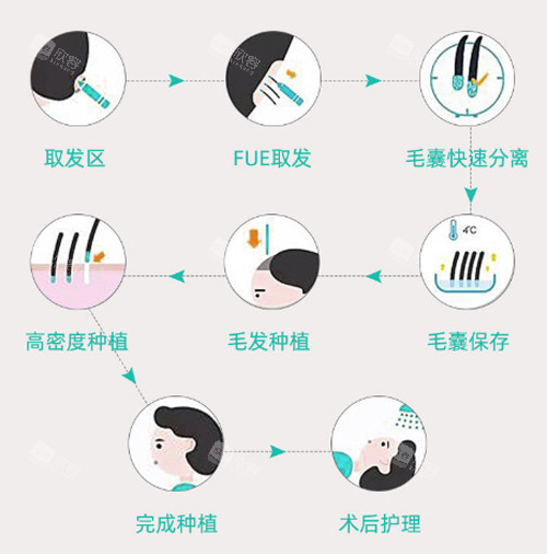 植发过程图 植发过程图