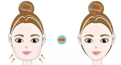 下颌角截骨动画对比图