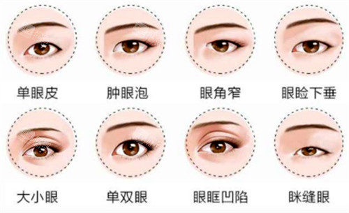 芜湖双眼皮修复医院排名,罗列芜湖口碑好的眼修复医院!