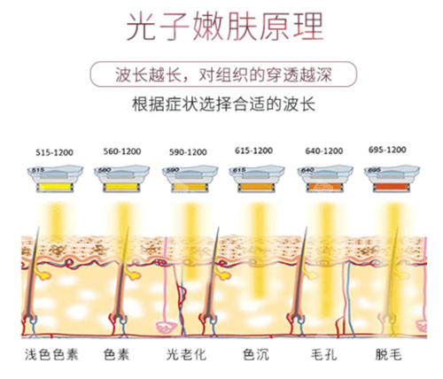 光子嫩肤的原理图解 光子嫩肤的原理图解