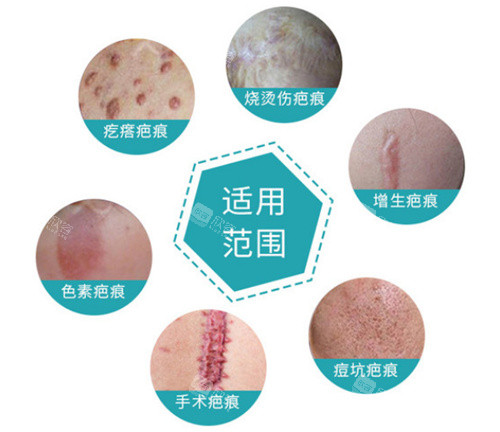 不同疤痕展示 不同疤痕展示
