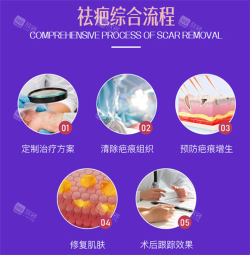 祛疤流程图 祛疤流程图