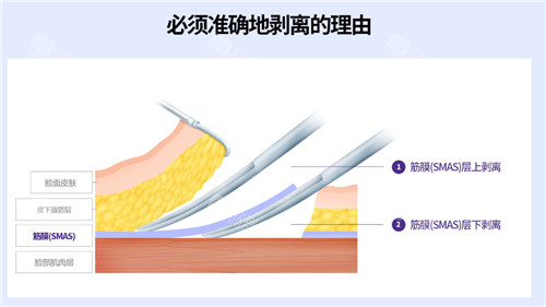 皮肤层次图示