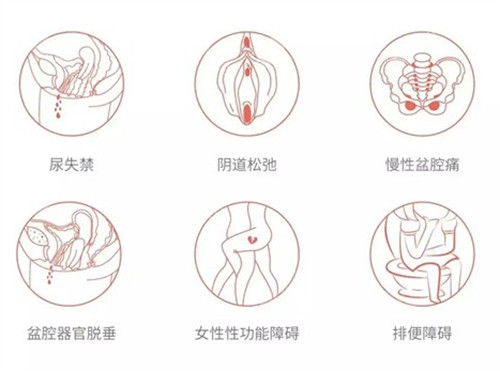 阴道松弛的危害图解 阴道松弛的危害图解