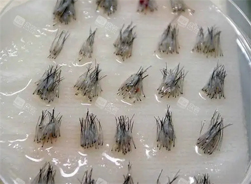 毛囊照片 毛囊照片