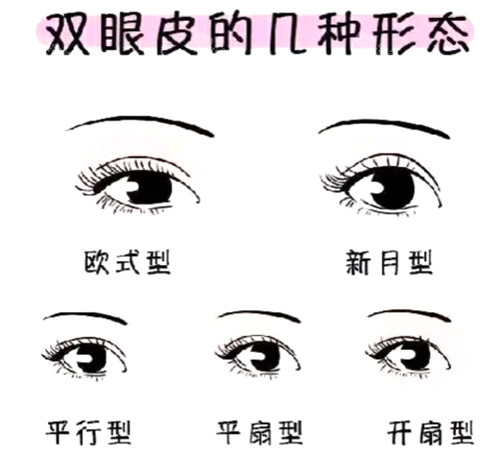 双眼皮几种形态展示 双眼皮几种形态展示