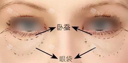 眼周组织图 眼周组织图