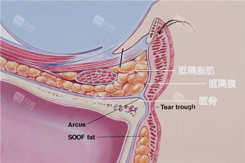 眼袋结构图示