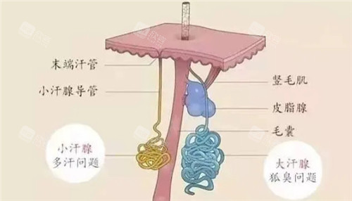 狐臭问题动画图示