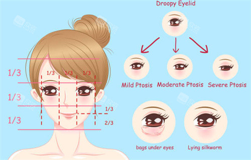 双眼皮设计方案一览图片