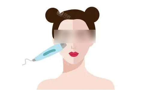 光子嫩肤流程图 光子嫩肤流程图