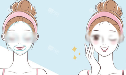 光子嫩肤前后对比的动画图 光子嫩肤前后对比的动画图