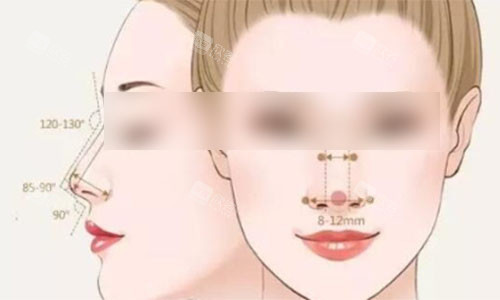 适合做隆鼻手术的都是哪些人呢？你适合吗?