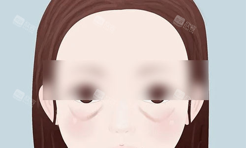 形成眼袋的动画图