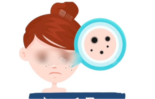 脸上长斑的动画图 脸上长斑的动画图