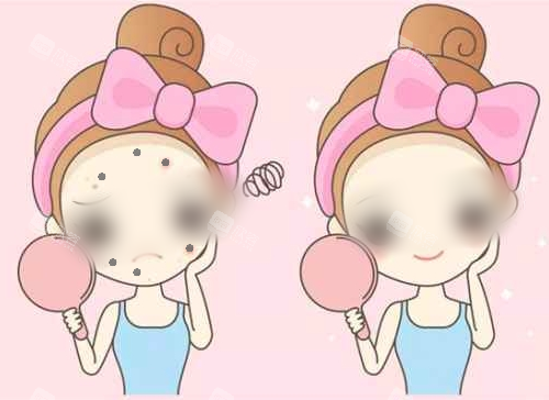 祛斑对比漫画图 祛斑对比漫画图
