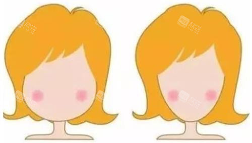 打针瘦脸明显对比图 打针瘦脸明显对比图