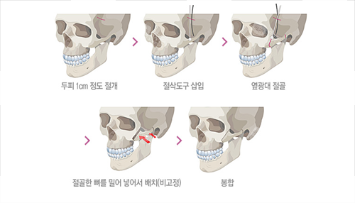 下颧骨动漫骷髅示意图