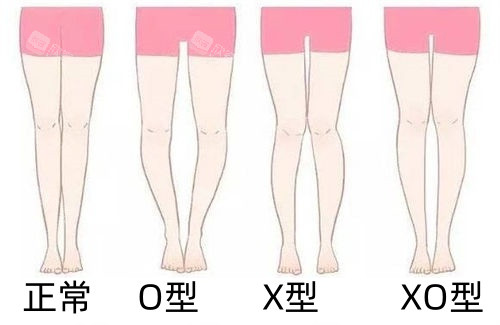 四种腿型展示图