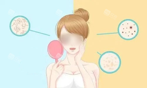 皮肤状态动画示意图 皮肤状态动画示意图