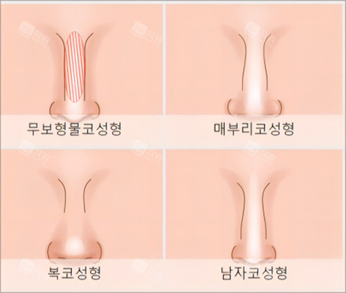 鼻型素材图 鼻型素材图